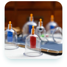 Hijama cupping therapy treatment